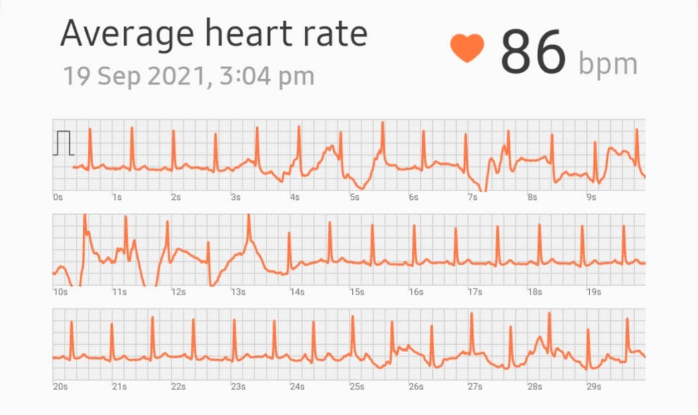 Ecg watch 4 online